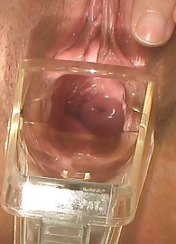 Simony Diamond Photo 15