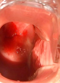 Electra Angels Photo 13