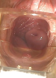 Simony Diamond Photo 15