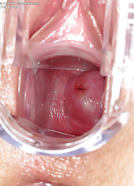 Kala Ferard Photo 15