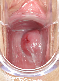 Madison Parker Photo 16